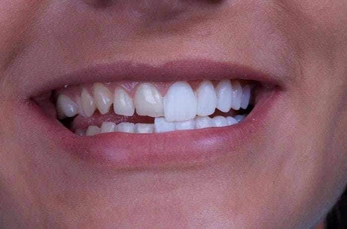 آیا لمینت برای شما مناسب است؟